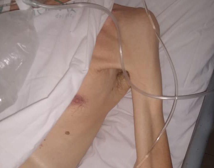 Denuncian a un geriátrico de Porteña por abandono de persona