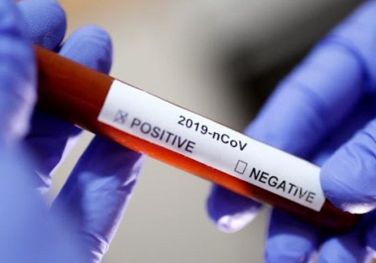 Primer caso de coronavirus en Ceres