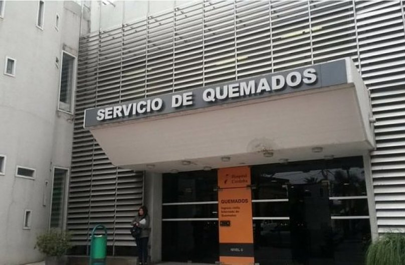 Morteros: La mujer quemada por su hijo se encuentra estable