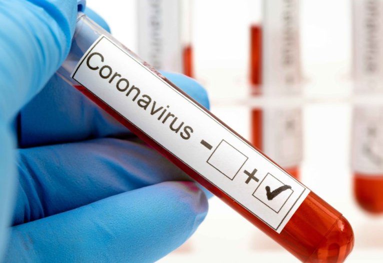Coronavirus: Balnearia tiene 4 casos y se suman Chipión y La Para