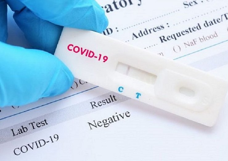 Santa Fe adquirió 10 mil test para la detección del coronavirus