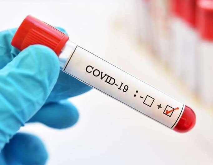Brinkmann informó otros dos casos de covid 19