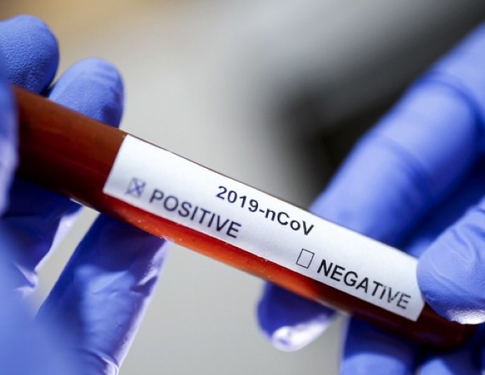 Santa Fe informó más de 300 casos de coronavirus