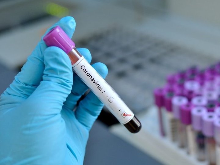 Sunchales sigue con números altos y en Ceres hay preocupación por las internaciones