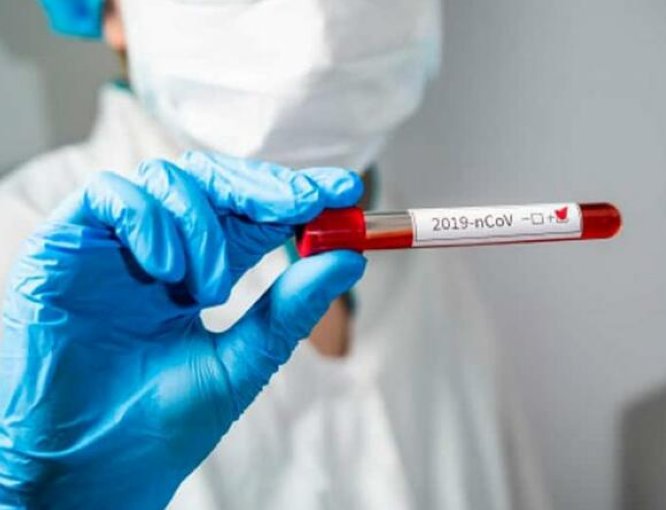 La provincia volvió a superar los 2000 contagios de coronavirus