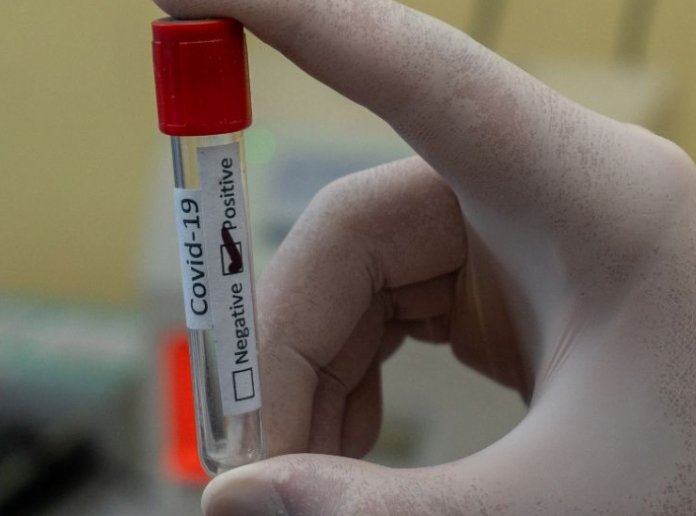 Segundo reporte sin casos de covid en Suardi