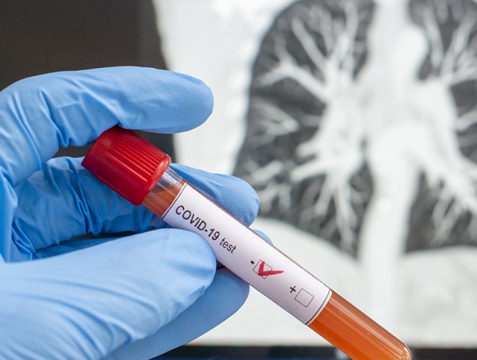 Suardi cumple 20 días sin coronavirus