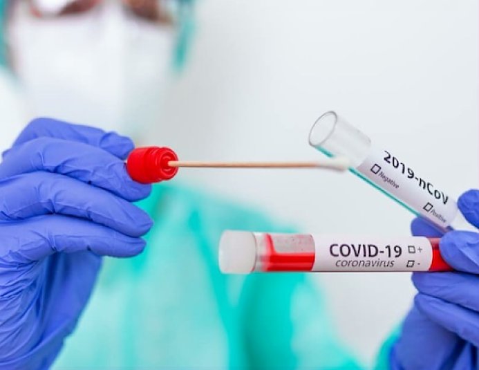 Sólo 10 casos y ninguna muerte por coronavirus en la provincia