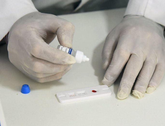 Santa Fe confirmó otros 58 casos de coronavirus