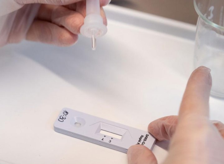 Bioquímicos no están convencidos sobre los beneficios del autotest