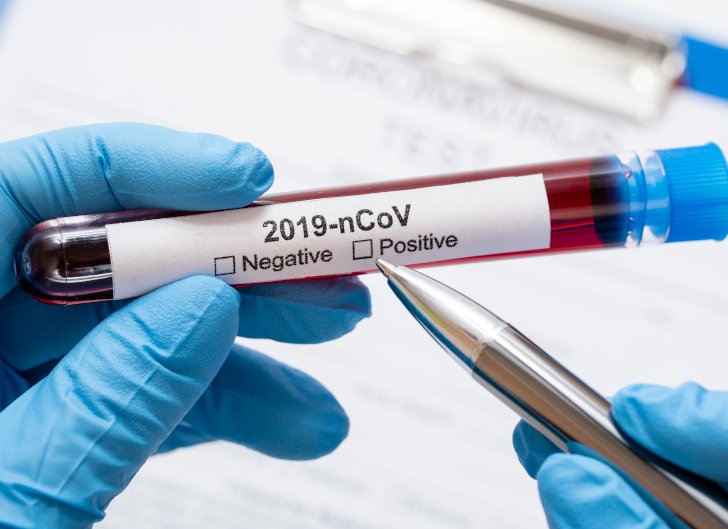 Coronavirus: La provincia estuvo por debajo de los 2000 casos
