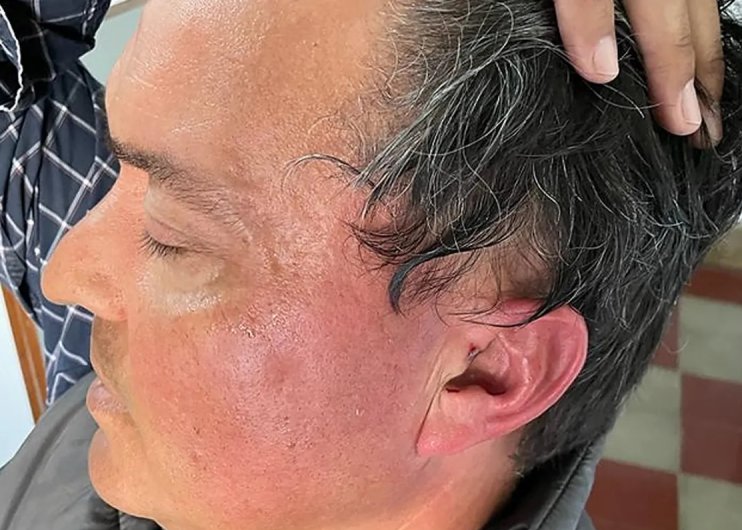 Presidente Comunal de Saralegui agredió a un productor agropecuario