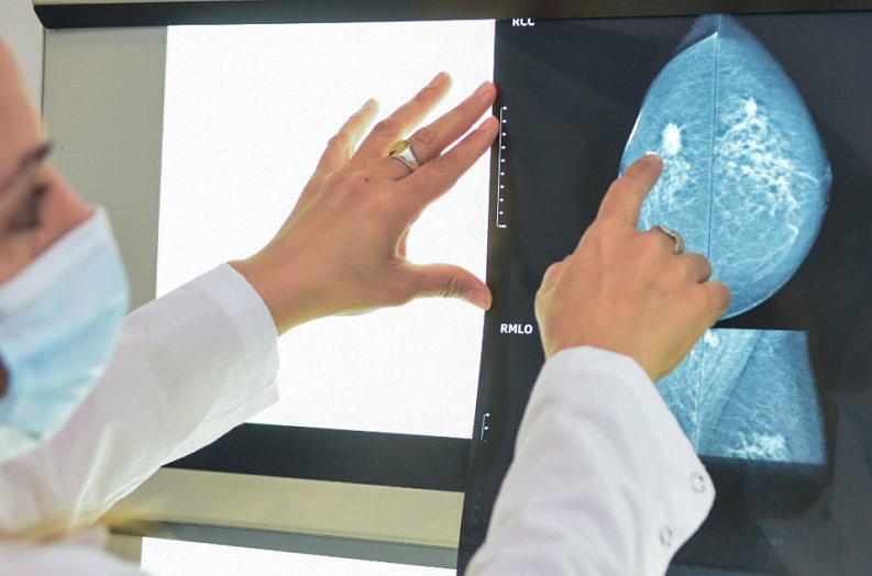 Brindan recomendaciones en el Día Mundial de la Lucha contra el Cáncer de Mama