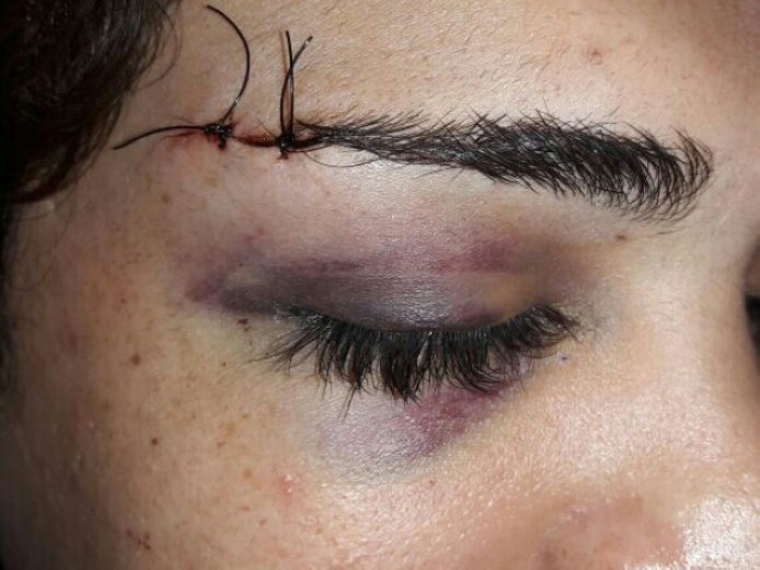 Agredieron a un transexual en Ceres